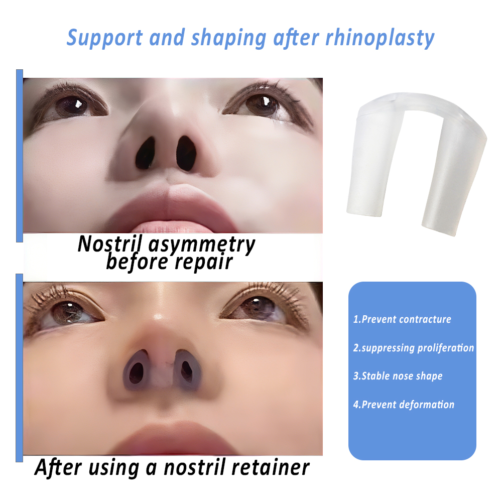 Nostril Retainer for Rhinoplas - огляд і ціна Anti Snore Contour Pillow